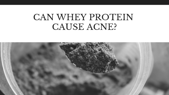 Does Whey Protein Cause Acne? Everything You Need To Know